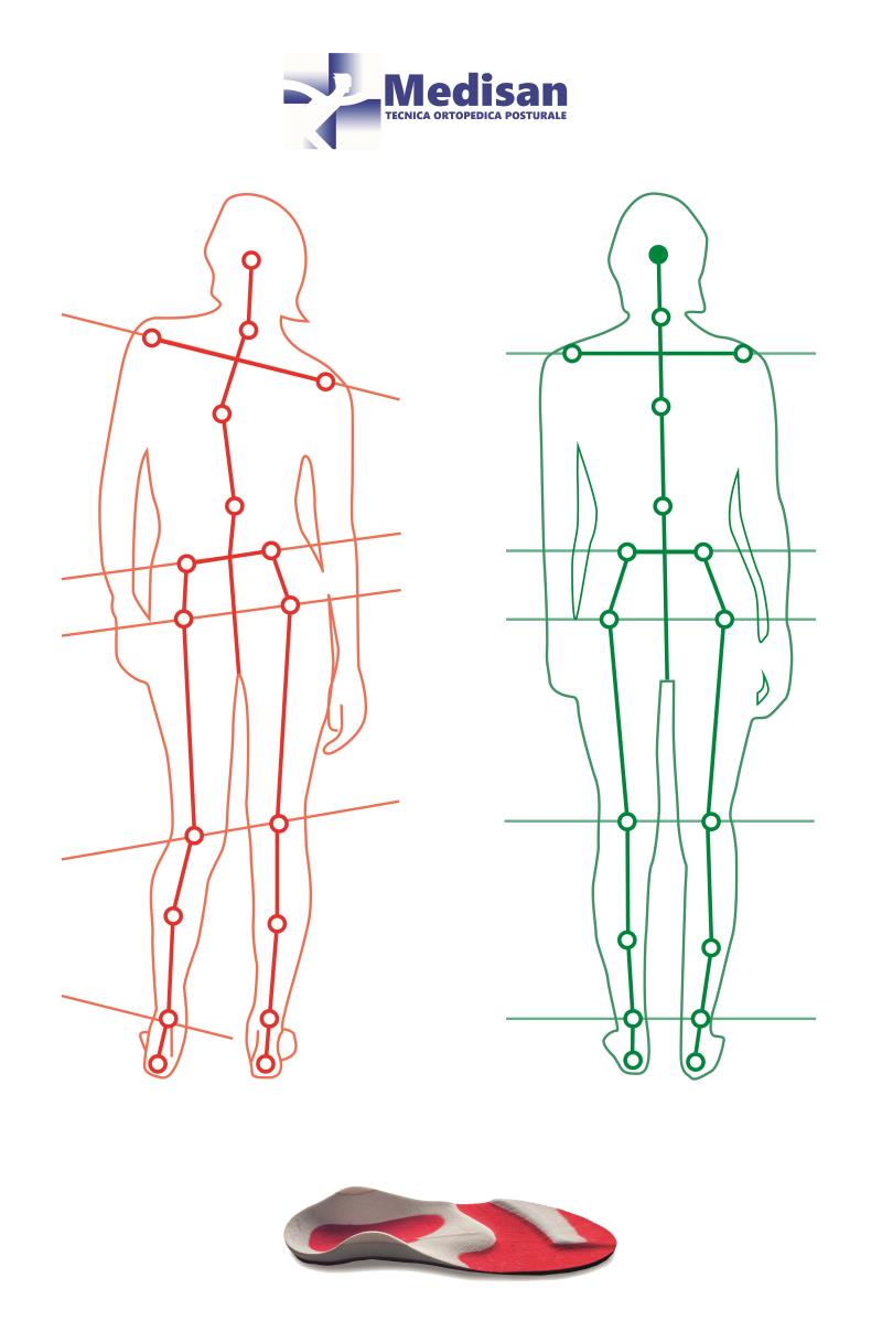 Medisan - Tecnica Ortopedica e Posturale